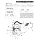 INTRACARDIAL ELECTRODE LINE AND CARDIAC STIMULATOR diagram and image