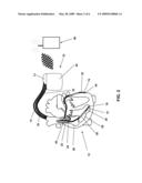 INTRACARDIAL ELECTRODE LINE AND CARDIAC STIMULATOR diagram and image