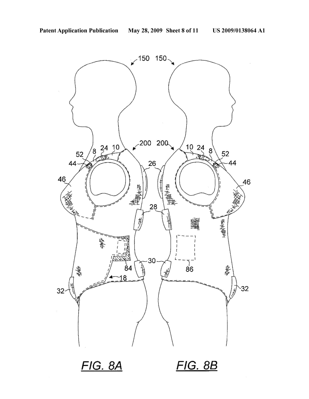 Garment for Providing Back Support and Thermal Therapy - diagram, schematic, and image 09