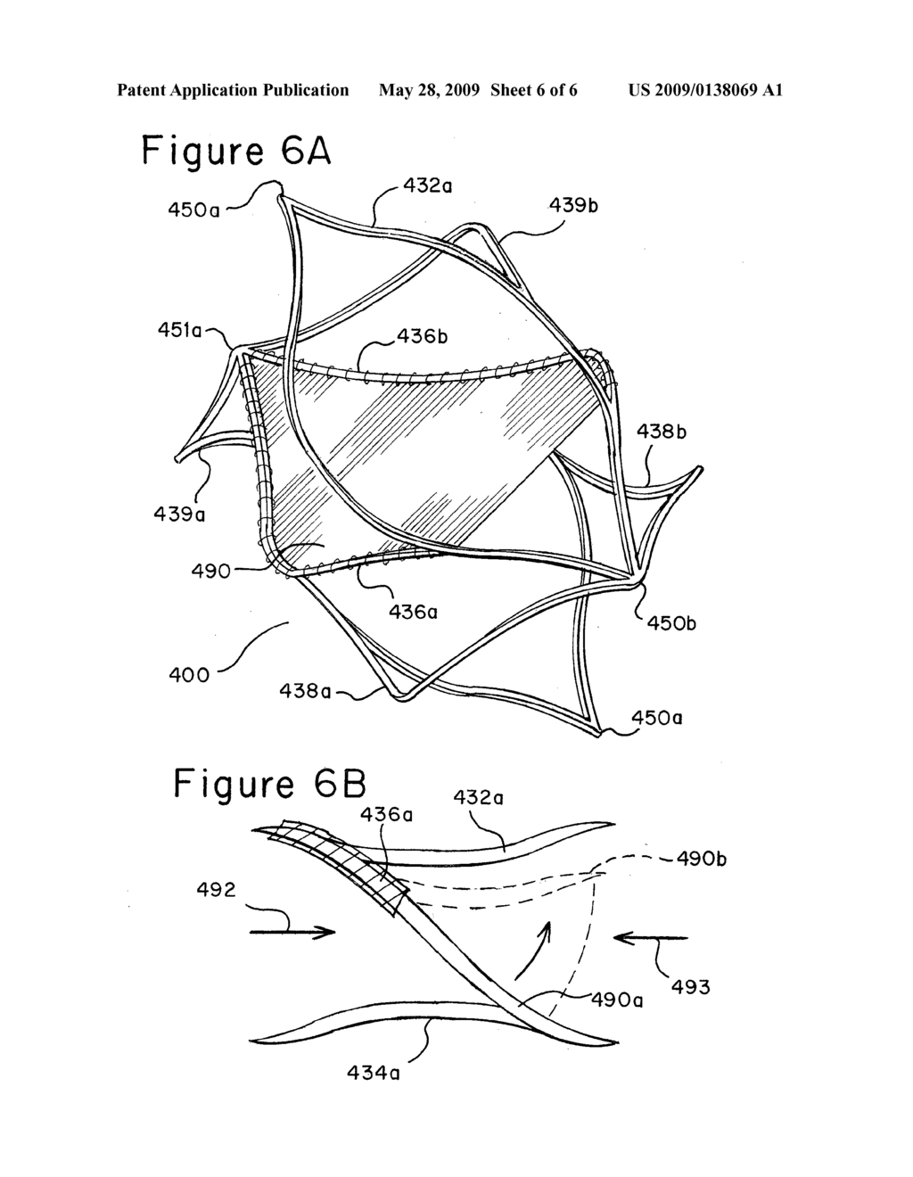 Implantable Frame and Valve Design - diagram, schematic, and image 07