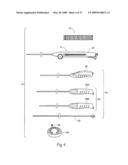 Devices, systems, and methods for endovascular staple and/or prosthesis delivery and implantation diagram and image