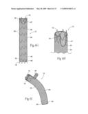 Devices, systems, and methods for endovascular staple and/or prosthesis delivery and implantation diagram and image