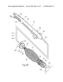 Devices, systems, and methods for endovascular staple and/or prosthesis delivery and implantation diagram and image