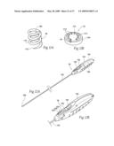 Devices, systems, and methods for endovascular staple and/or prosthesis delivery and implantation diagram and image