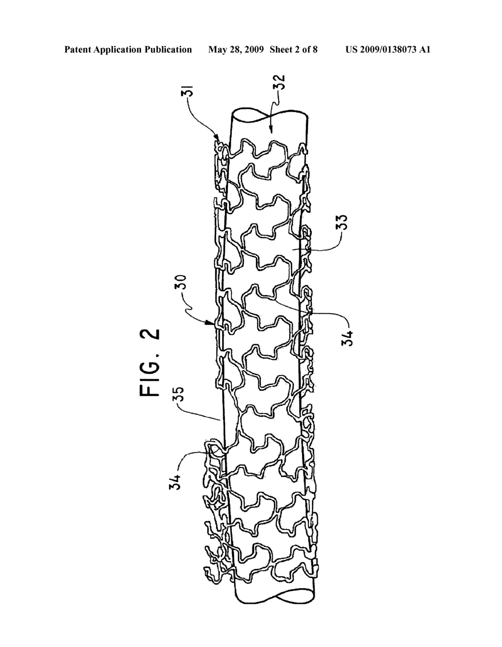 Bifurcation Stent Assembly - diagram, schematic, and image 03