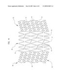 Bifurcation Stent Assembly diagram and image