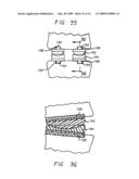VERTEBRAL IMPLANTS ADAPTED FOR POSTERIOR INSERTION diagram and image
