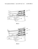 Stackable Intervertebral Devices and Methods of Use diagram and image