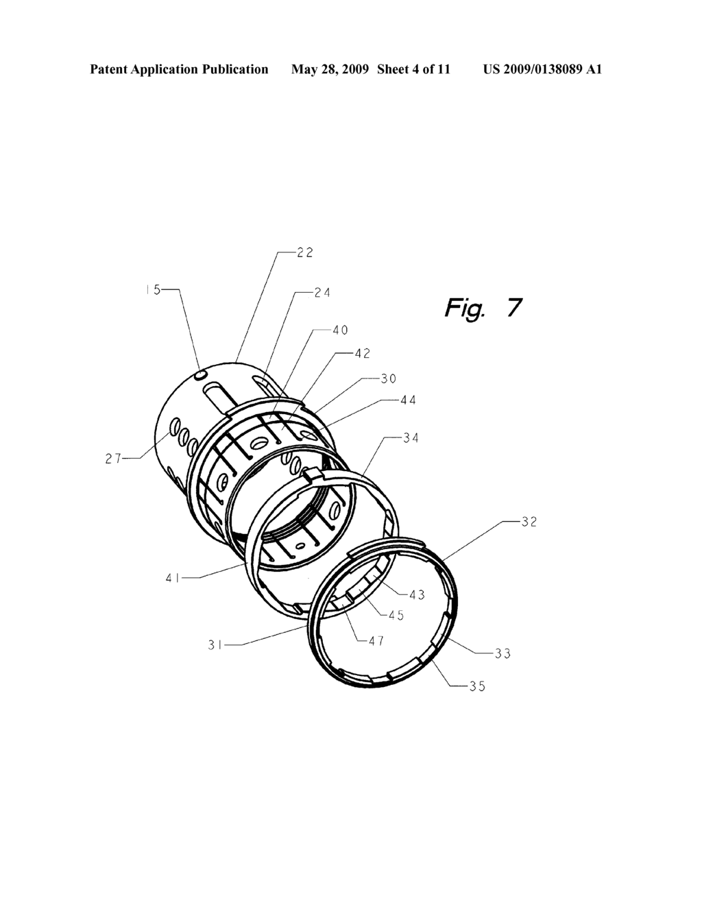 Corpectomy implant - diagram, schematic, and image 05