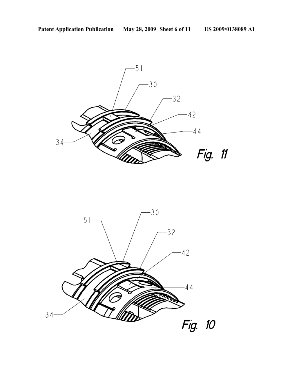 Corpectomy implant - diagram, schematic, and image 07