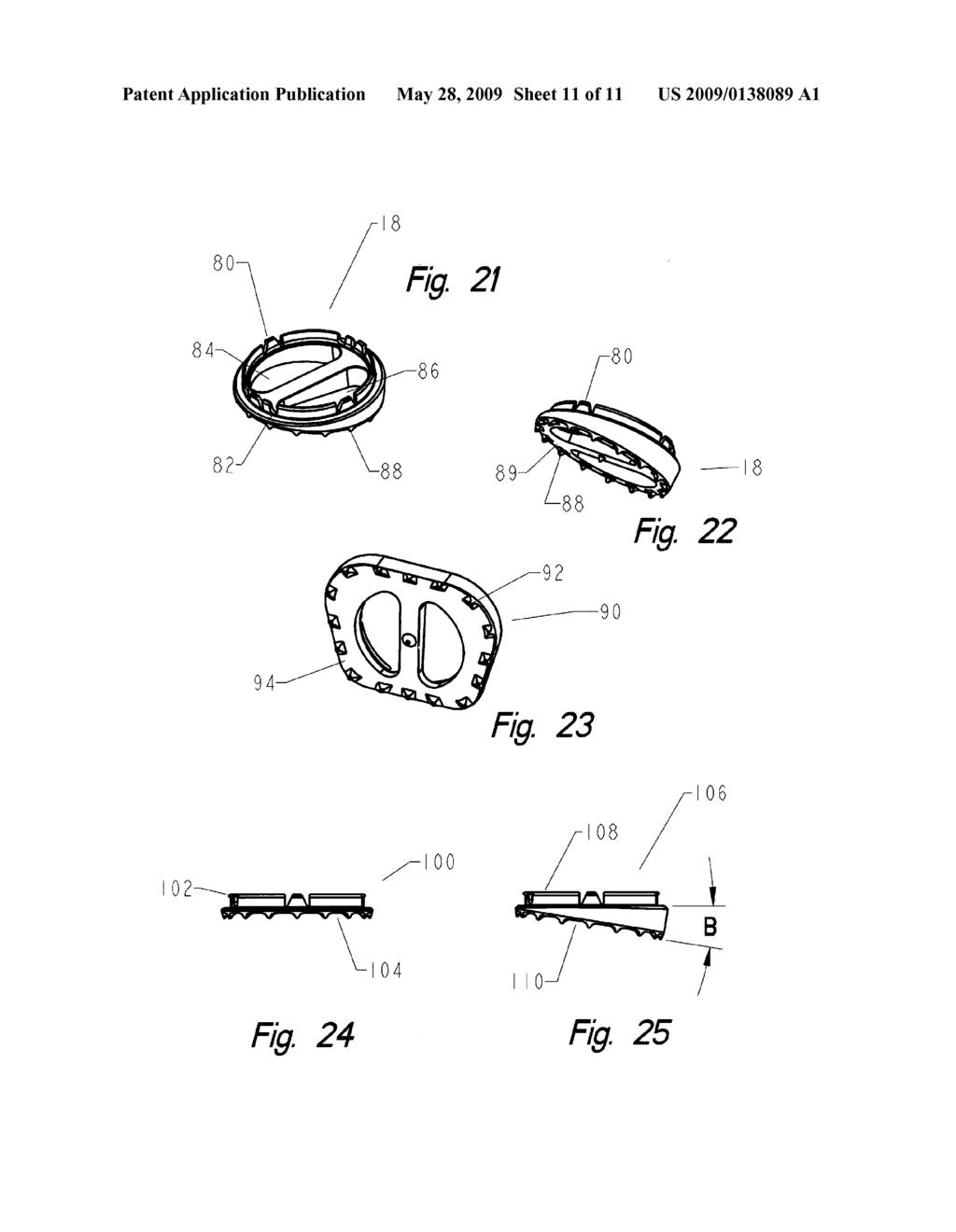 Corpectomy implant - diagram, schematic, and image 12