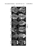 MODIFICATION OF PLANT DISEASE RESISTANCE diagram and image