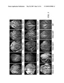 MODIFICATION OF PLANT DISEASE RESISTANCE diagram and image