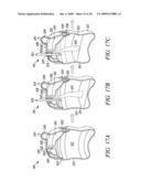 LIQUID NUTRITION PRODUCT DISPENSER WITH PLURAL PRODUCT CHAMBERS FOR SEPARATE STORAGE AND INTERMIXING PRIOR TO USE, AND RELATED METHOD diagram and image