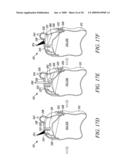 READY TO FEED CONTAINER WITH DRINKING DISPENSER AND SEALING MEMBER, AND RELATED METHOD diagram and image