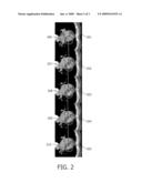 MOTION COMPENSATED CT RECONSTRUCTION OF HIGH CONTRAST OBJECTS diagram and image