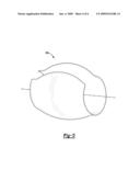 CIRCUMFERENTIAL SEALING ARRANGEMENT diagram and image