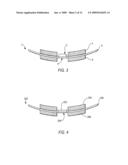 DISH SHAPED AND PRESSURE EQUALIZING ELECTRODES FOR ELECTROCHEMICAL BATTERIES diagram and image