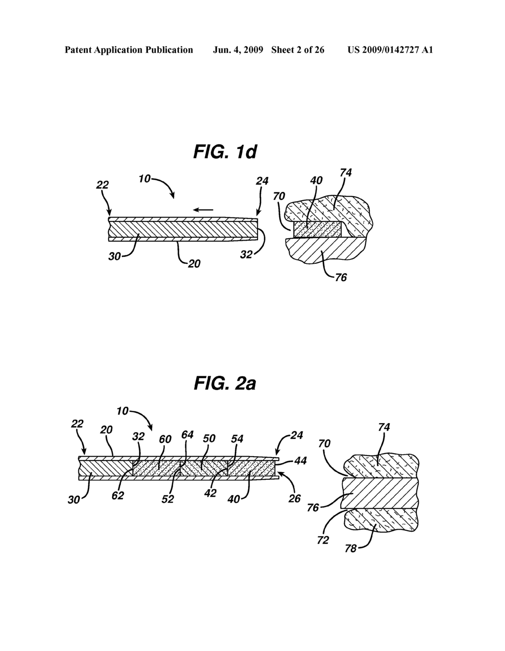 DEVICE FOR DELIVERING MEDICINAL IMPLANTS - diagram, schematic, and image 03