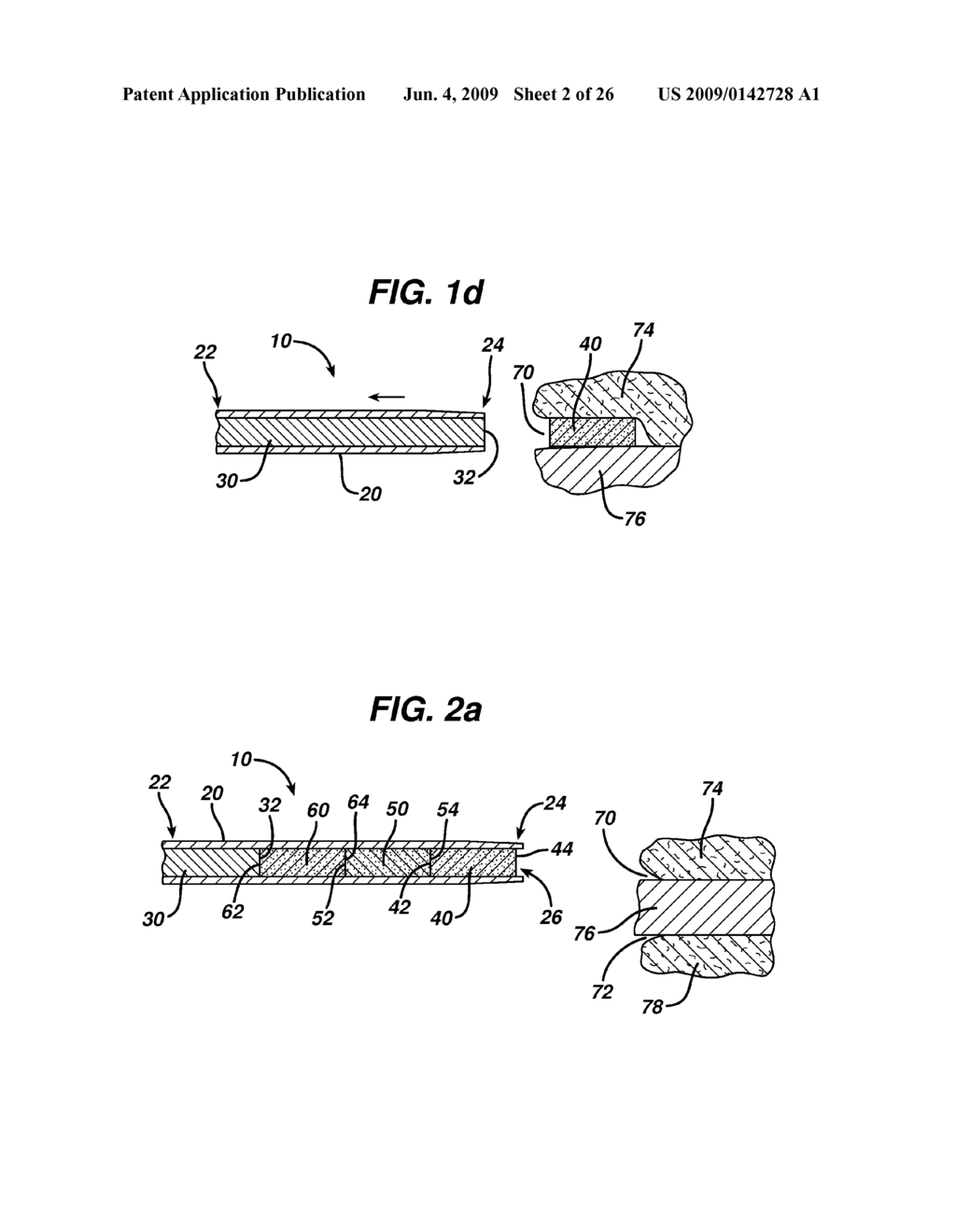 ACTUATORS FOR DEVICE FOR DELIVERING MEDICINAL IMPLANTS - diagram, schematic, and image 03