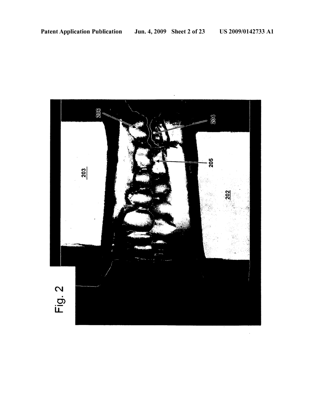 SUPPORT STRUCTURE FOR A PRINTED MODEL IN MULTI-COMPONENT DENTAL APPLIANCES - diagram, schematic, and image 03