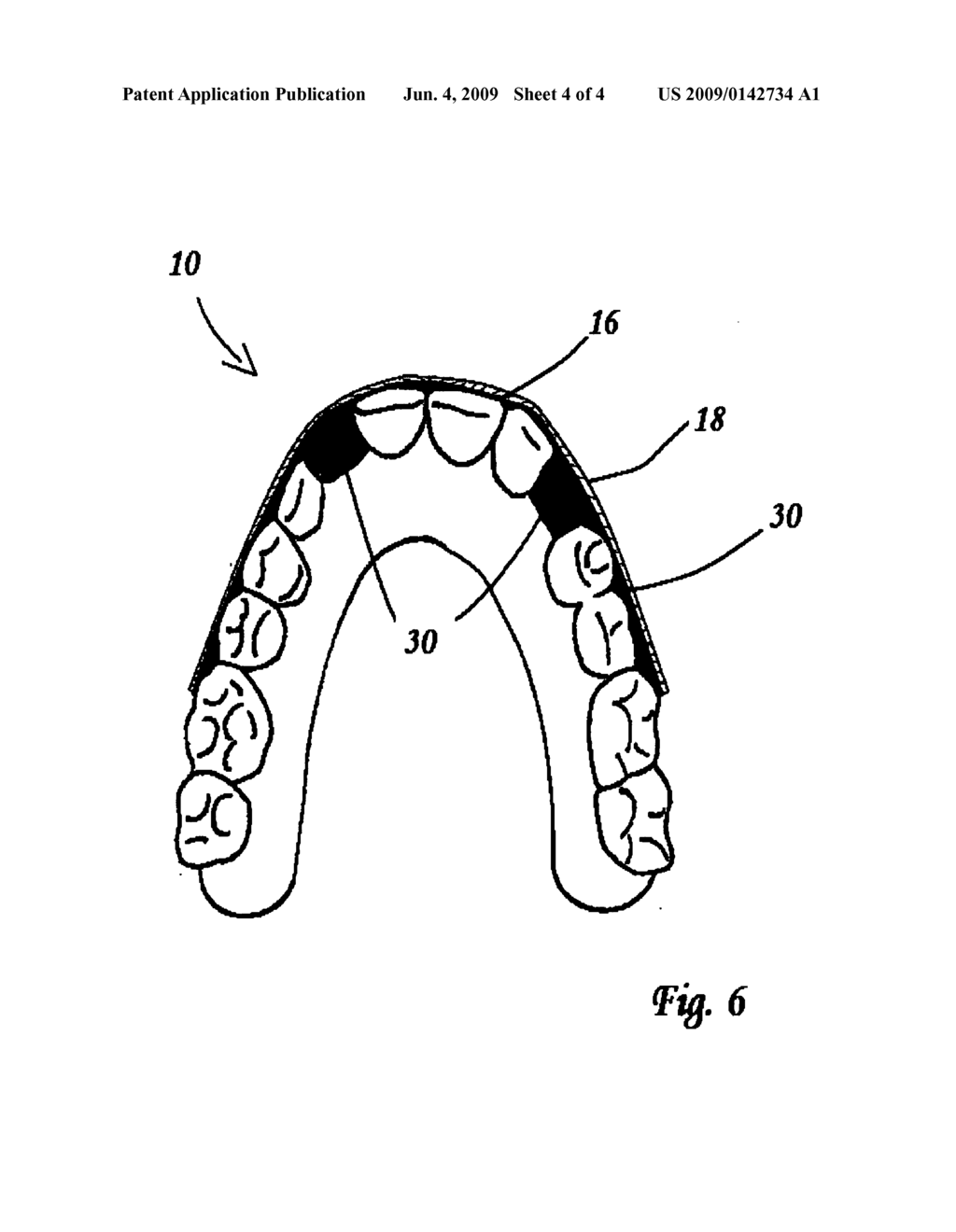 Cosmetic accessory device for teeth - diagram, schematic, and image 05