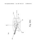 METHOD AND SYSTEM FOR INTERACTIVE PERCUTANEOUS PRE-OPERATION SURGICAL PLANNING diagram and image