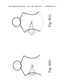 METHOD AND SYSTEM FOR INTERACTIVE PERCUTANEOUS PRE-OPERATION SURGICAL PLANNING diagram and image