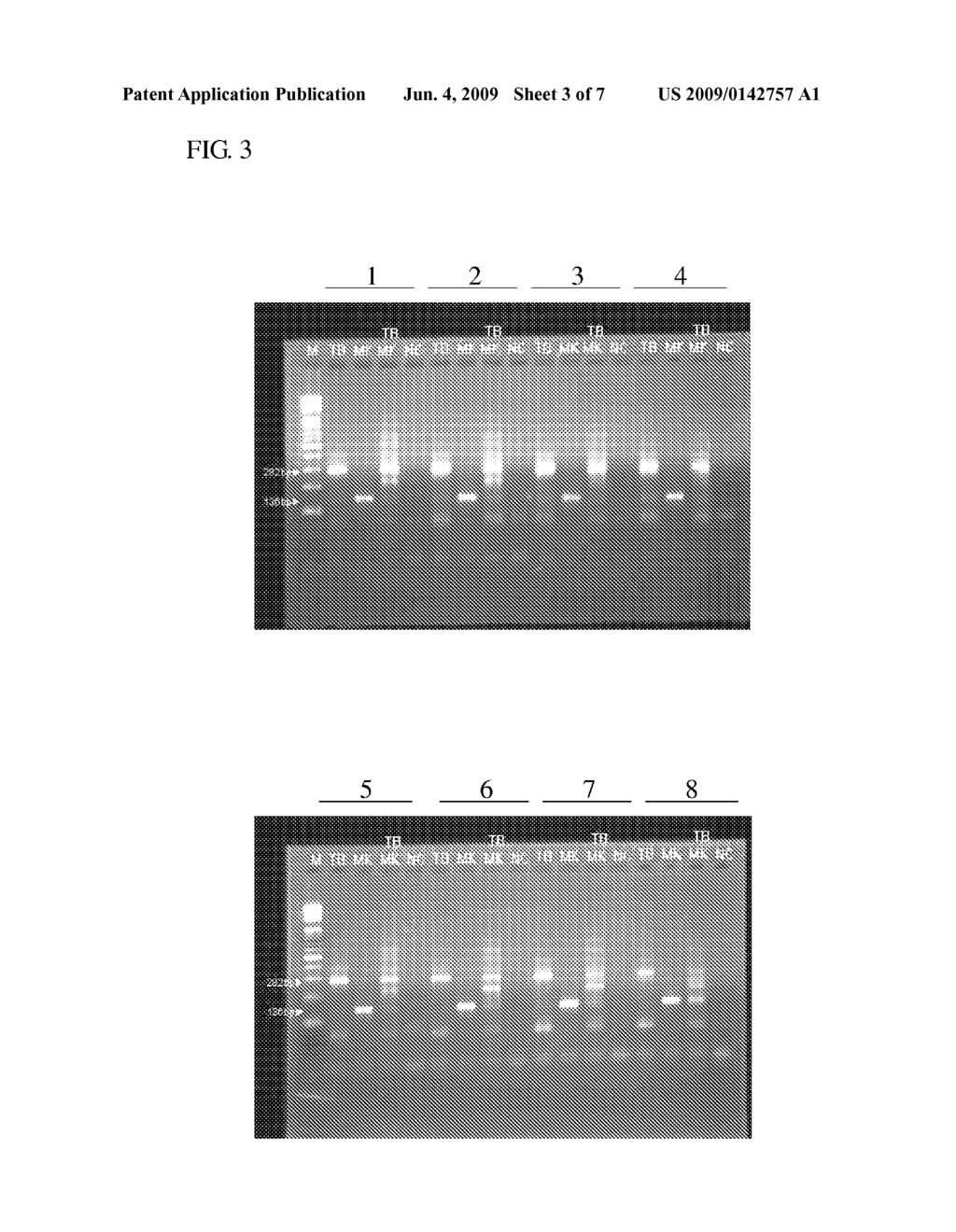 STRIP AND METHOD FOR DETECTING NUCLEOTIDE AMPLIFICATION PRODUCTS OF MYCOBACTERIUM TUBERCULOSIS AND NON-TUBERCULOUS MYCOBACTERIUM - diagram, schematic, and image 04