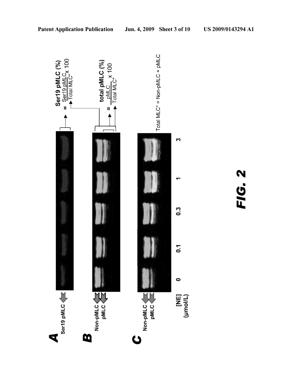 METHODS OF TREATING VASODILATORY SHOCK - diagram, schematic, and image 04