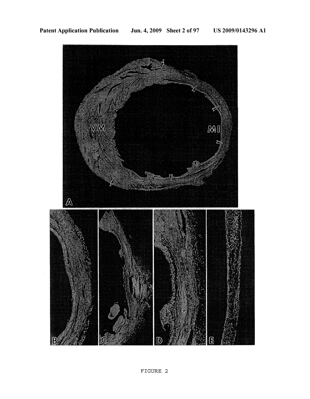 METHODS AND COMPOSITIONS FOR THE REPAIR AND/OR REGENERATION OF DAMAGED MYOCARDIUM - diagram, schematic, and image 03