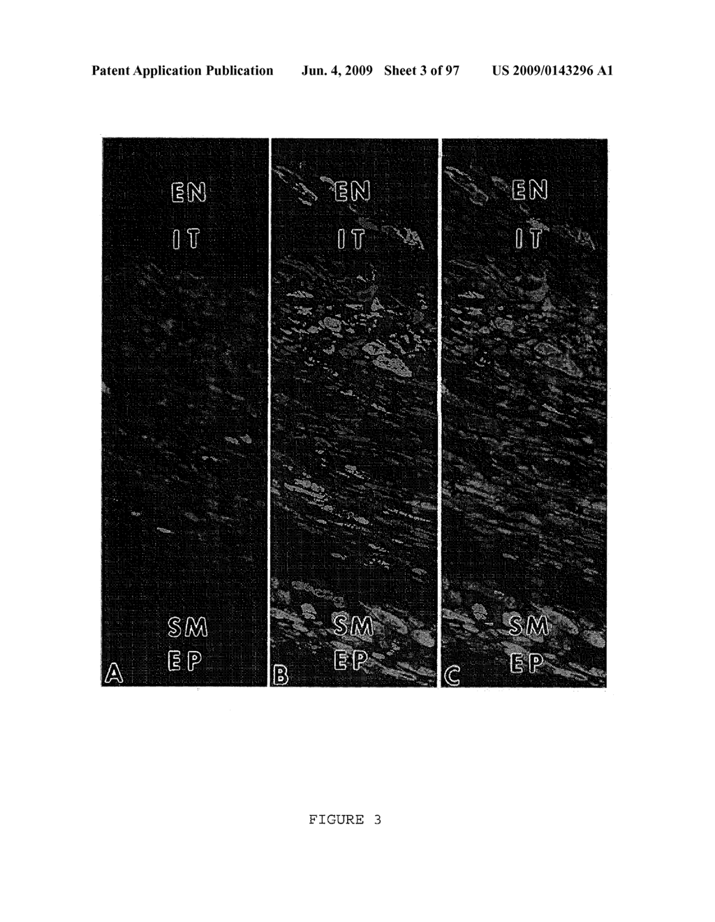 METHODS AND COMPOSITIONS FOR THE REPAIR AND/OR REGENERATION OF DAMAGED MYOCARDIUM - diagram, schematic, and image 04