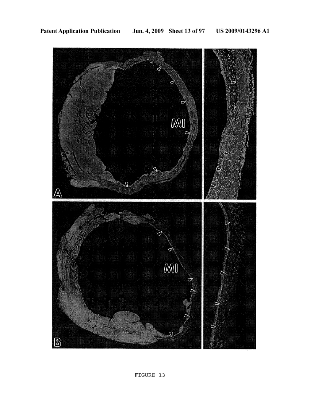 METHODS AND COMPOSITIONS FOR THE REPAIR AND/OR REGENERATION OF DAMAGED MYOCARDIUM - diagram, schematic, and image 14