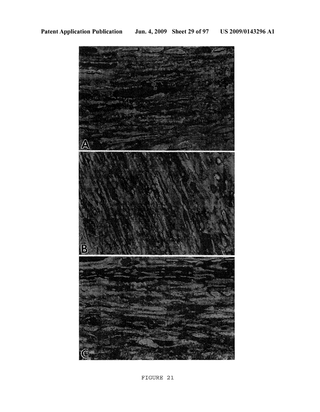 METHODS AND COMPOSITIONS FOR THE REPAIR AND/OR REGENERATION OF DAMAGED MYOCARDIUM - diagram, schematic, and image 30