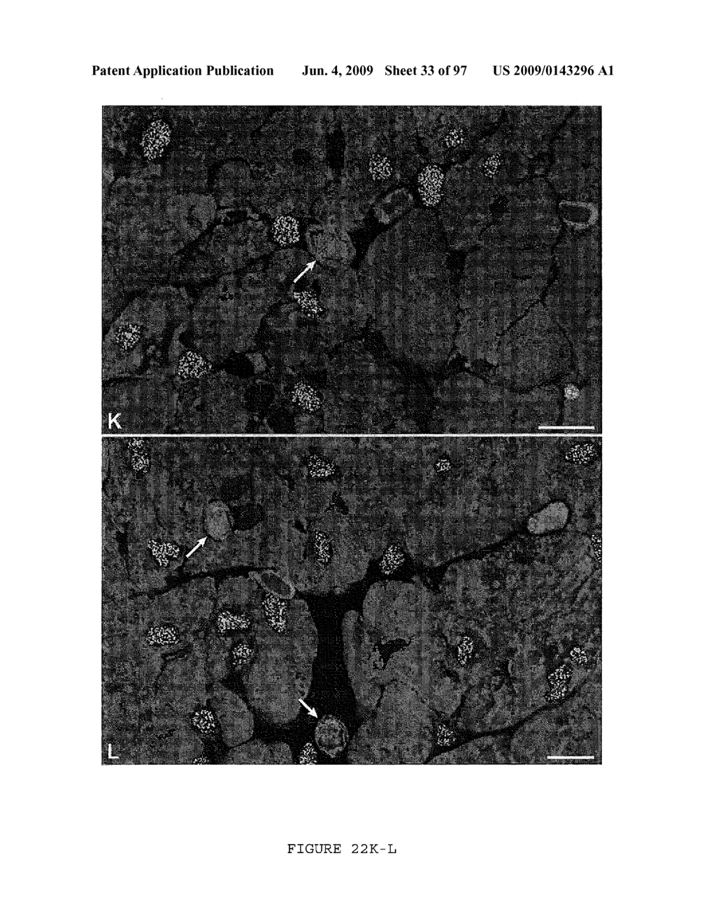 METHODS AND COMPOSITIONS FOR THE REPAIR AND/OR REGENERATION OF DAMAGED MYOCARDIUM - diagram, schematic, and image 34