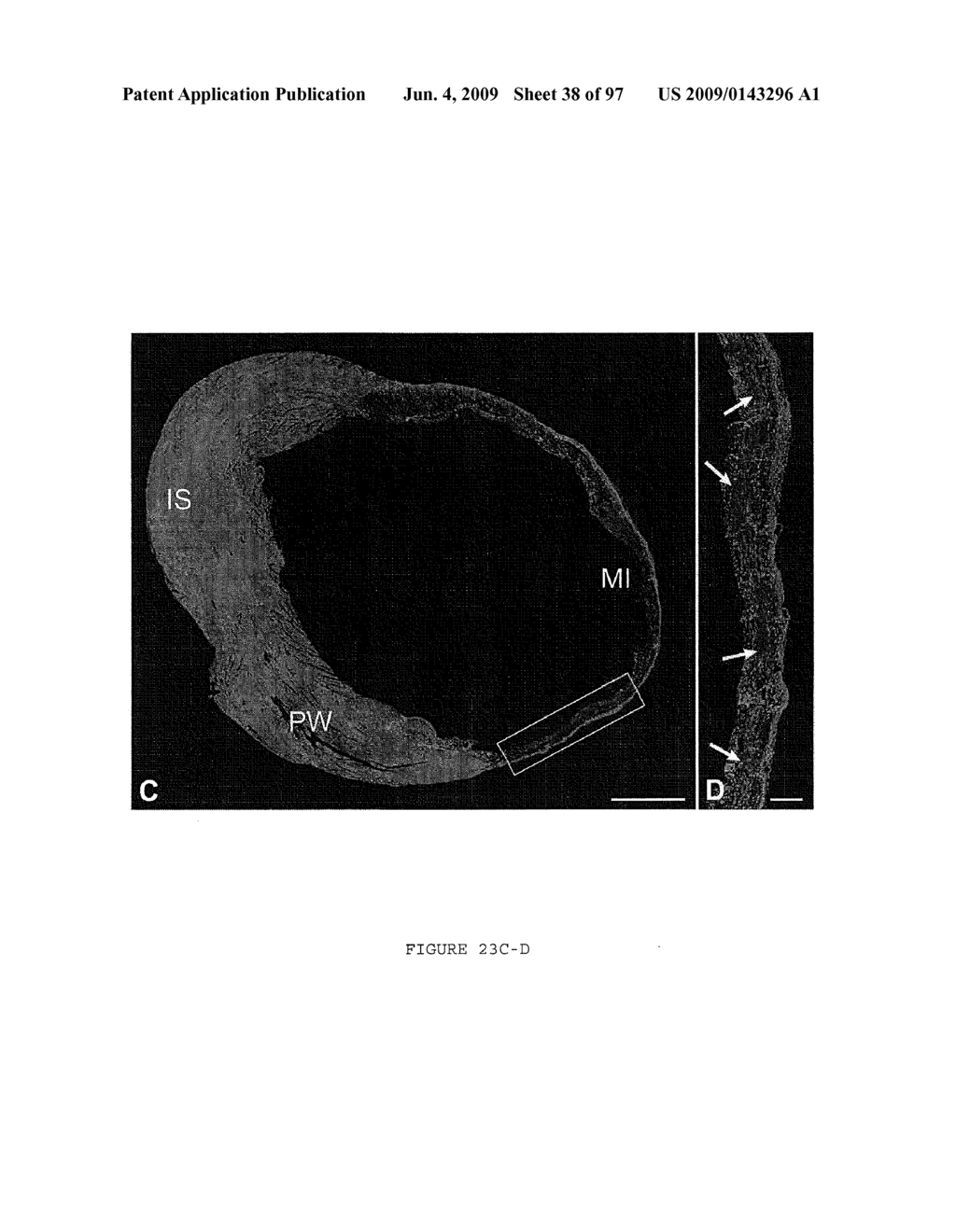 METHODS AND COMPOSITIONS FOR THE REPAIR AND/OR REGENERATION OF DAMAGED MYOCARDIUM - diagram, schematic, and image 39