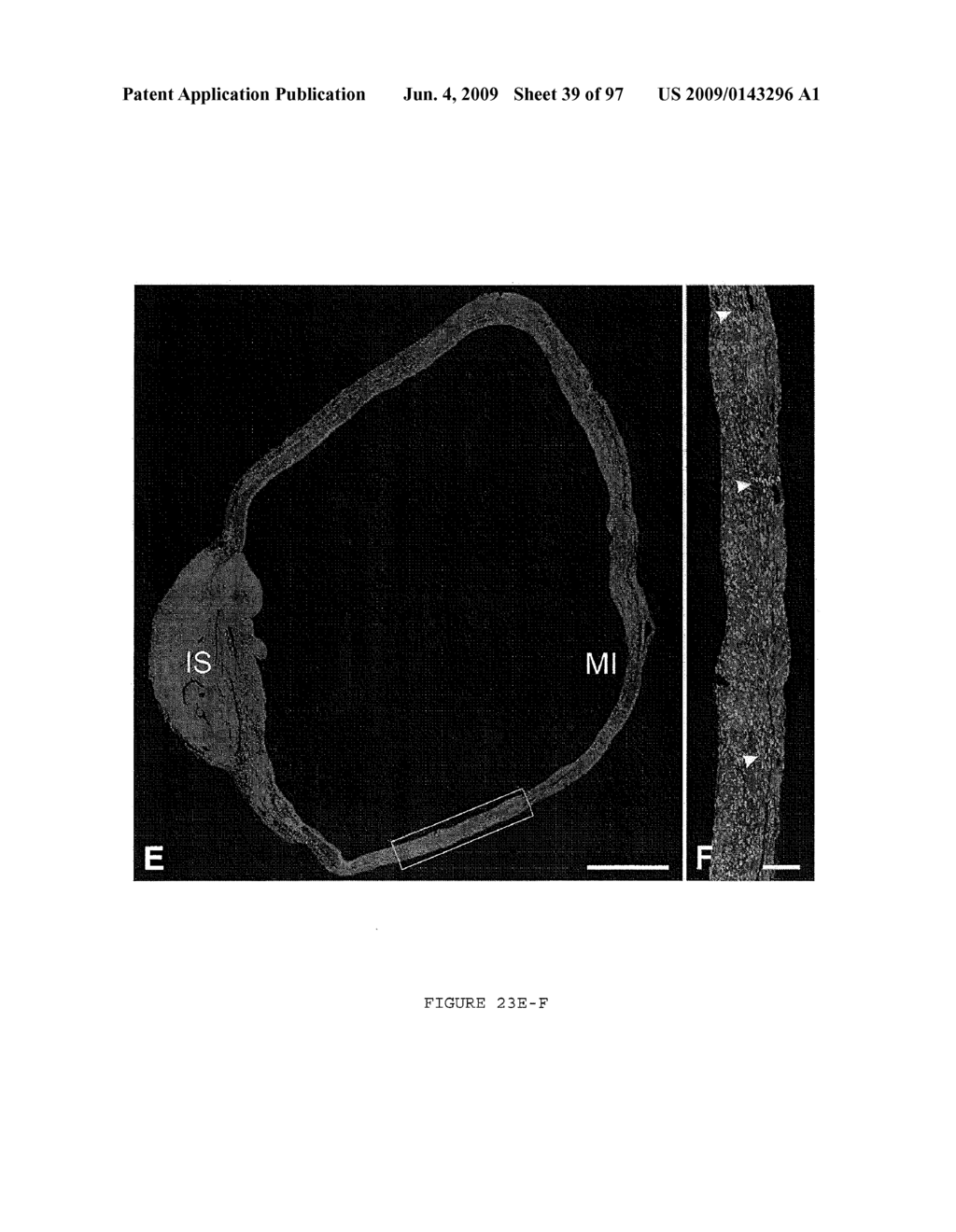 METHODS AND COMPOSITIONS FOR THE REPAIR AND/OR REGENERATION OF DAMAGED MYOCARDIUM - diagram, schematic, and image 40