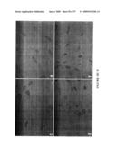 METHODS AND COMPOSITIONS FOR THE REPAIR AND/OR REGENERATION OF DAMAGED MYOCARDIUM diagram and image