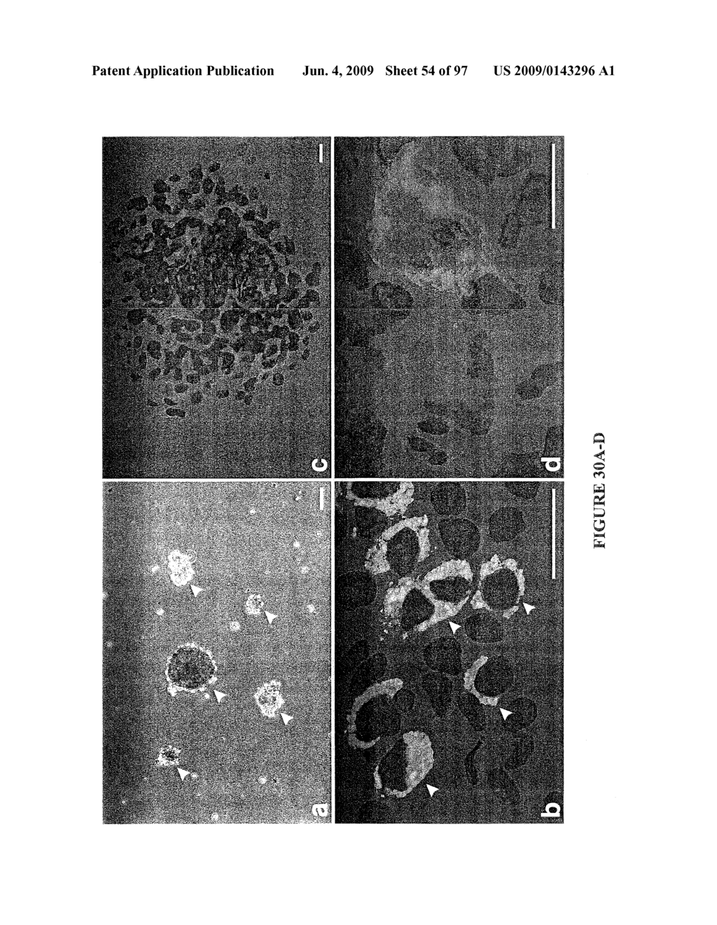 METHODS AND COMPOSITIONS FOR THE REPAIR AND/OR REGENERATION OF DAMAGED MYOCARDIUM - diagram, schematic, and image 55