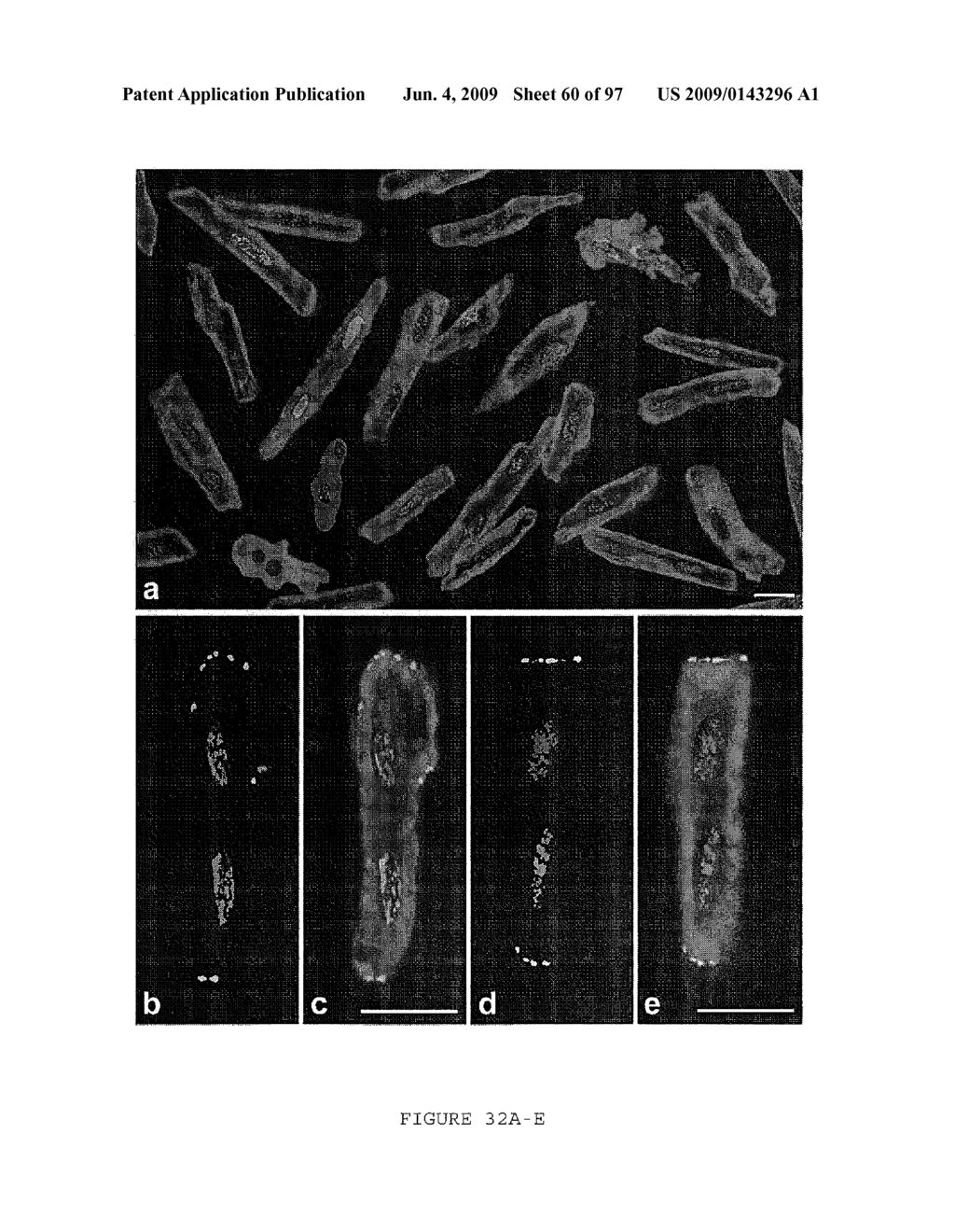 METHODS AND COMPOSITIONS FOR THE REPAIR AND/OR REGENERATION OF DAMAGED MYOCARDIUM - diagram, schematic, and image 61