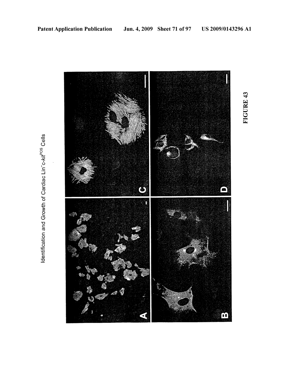 METHODS AND COMPOSITIONS FOR THE REPAIR AND/OR REGENERATION OF DAMAGED MYOCARDIUM - diagram, schematic, and image 72