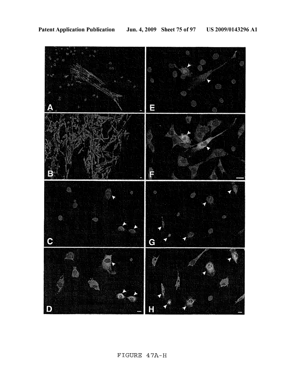 METHODS AND COMPOSITIONS FOR THE REPAIR AND/OR REGENERATION OF DAMAGED MYOCARDIUM - diagram, schematic, and image 76