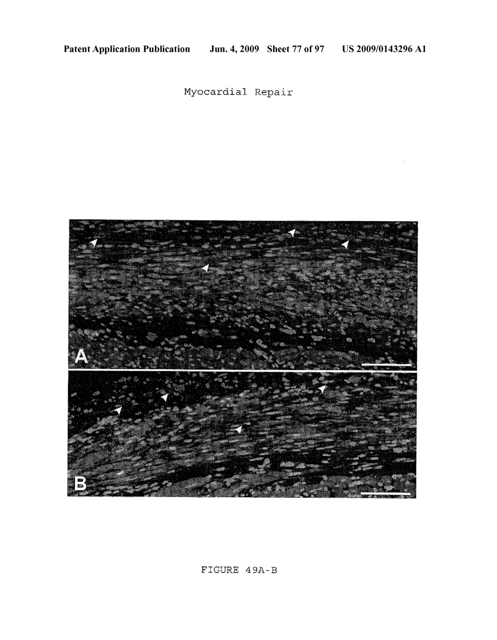 METHODS AND COMPOSITIONS FOR THE REPAIR AND/OR REGENERATION OF DAMAGED MYOCARDIUM - diagram, schematic, and image 78
