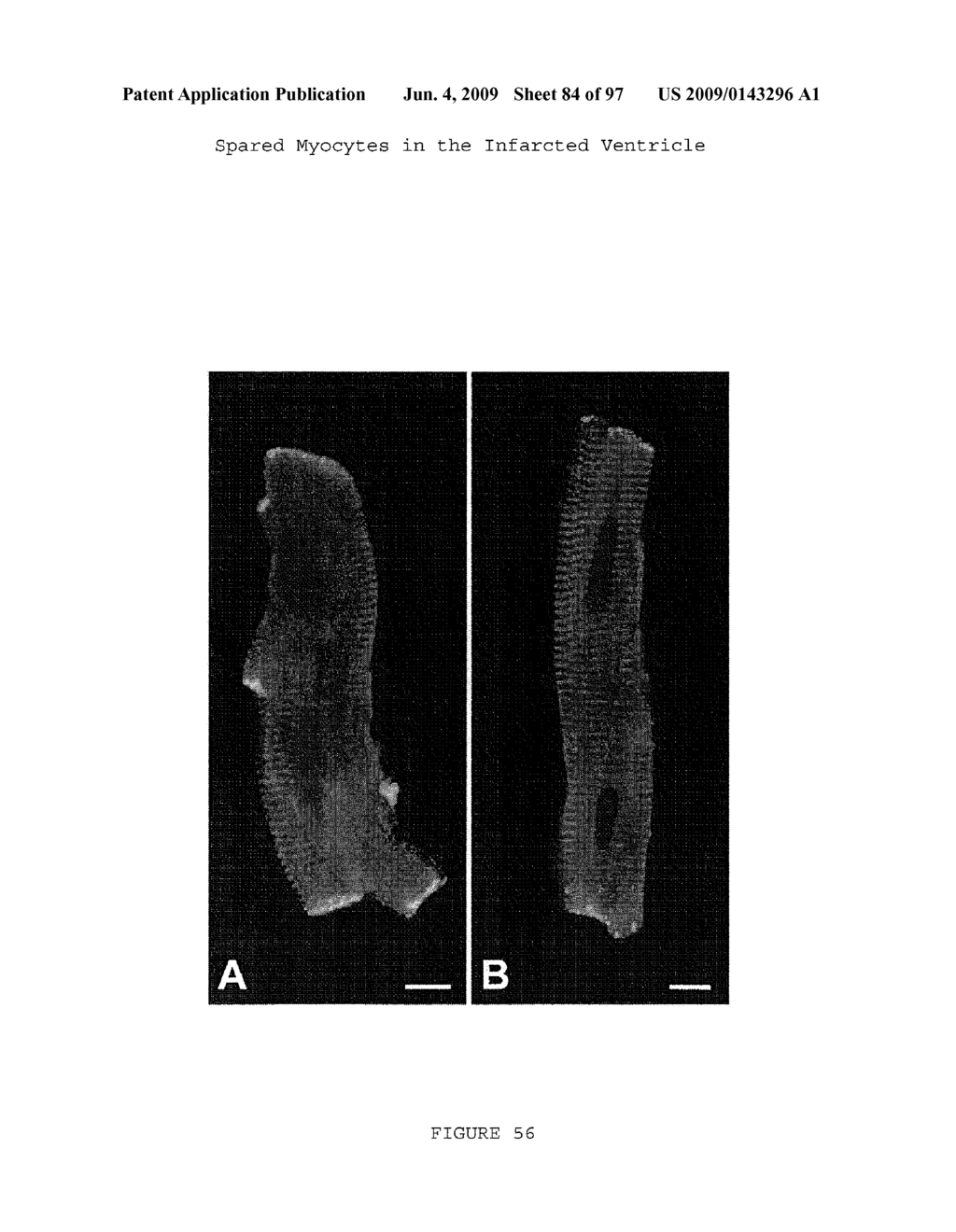 METHODS AND COMPOSITIONS FOR THE REPAIR AND/OR REGENERATION OF DAMAGED MYOCARDIUM - diagram, schematic, and image 85