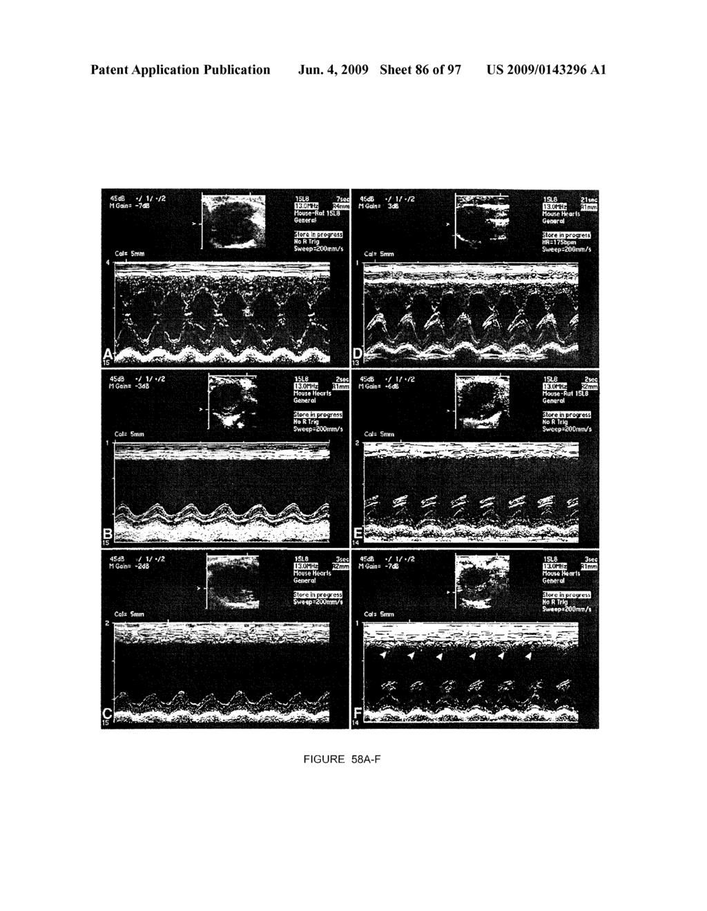 METHODS AND COMPOSITIONS FOR THE REPAIR AND/OR REGENERATION OF DAMAGED MYOCARDIUM - diagram, schematic, and image 87