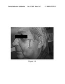 SILICONE GEL-BASED COMPOSITIONS FOR WOUND HEALING AND SCAR REDUCTION diagram and image
