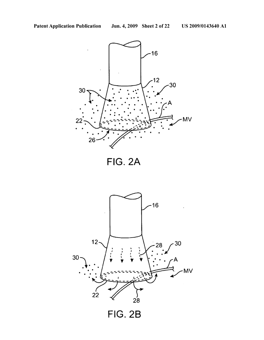 COMBINATION IMAGING AND TREATMENT ASSEMBLIES - diagram, schematic, and image 03