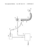 Catheter guided endotracheal intubation diagram and image