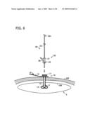 ENDOSCOPE SYSTEM FOR GASTROSTOMY CATHETER PLACEMENT diagram and image