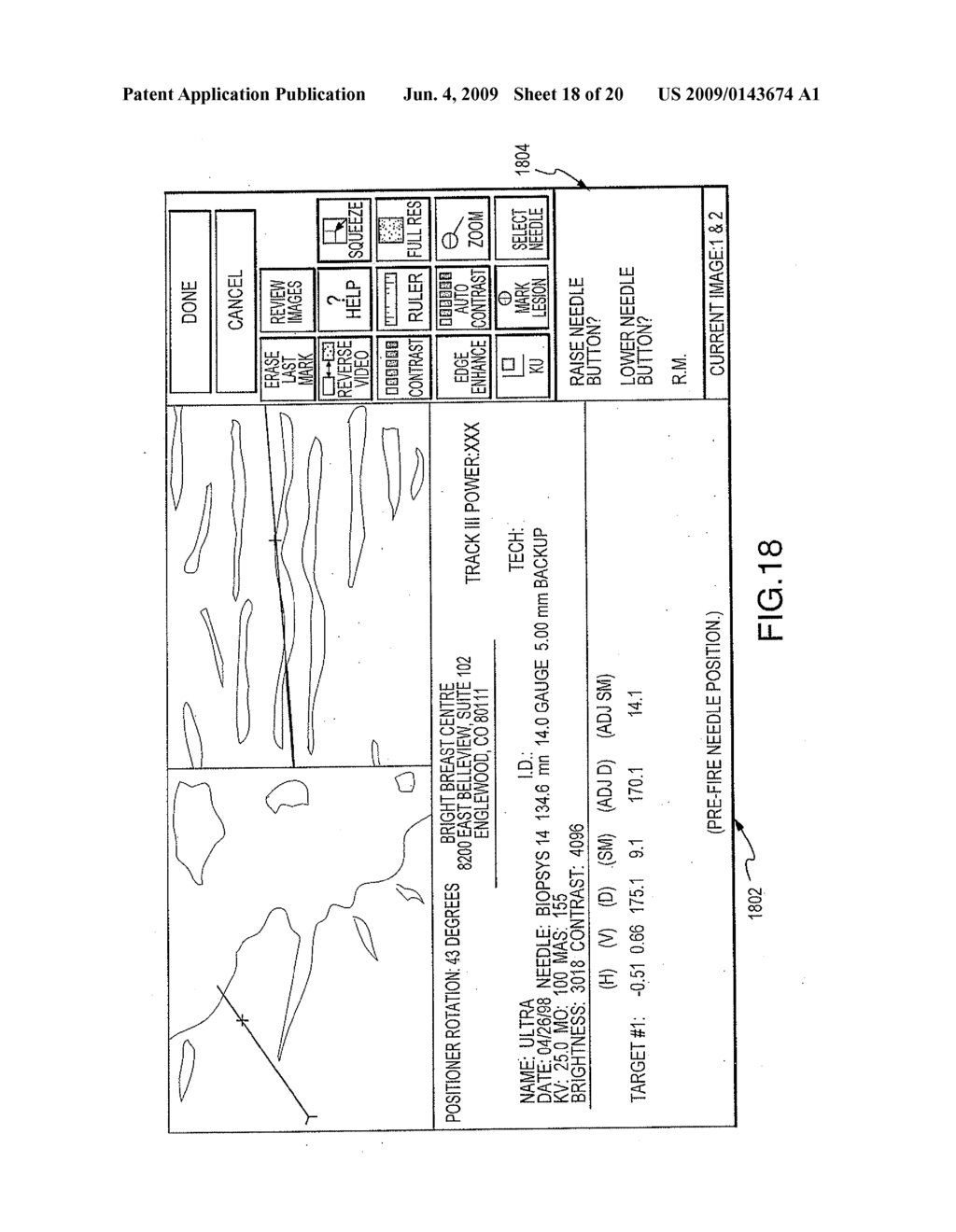 USER INTERFACE SYSTEM FOR MAMMOGRAPHIC IMAGER - diagram, schematic, and image 19